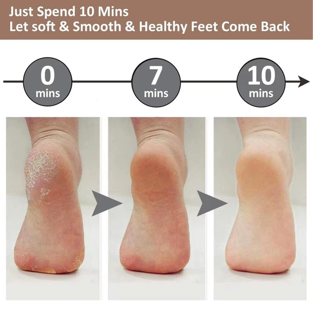 Electric Pedicure Foot File Callus Remover مزيل كالو القدم الكهربائي للعناية بالقدمين وإزالة الجلد الميت